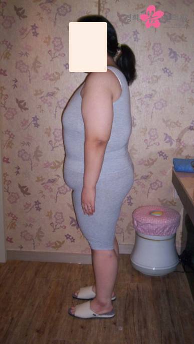 치료전이미지